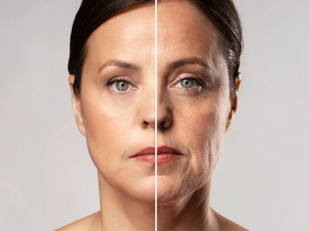 Rostro con mandíbula y pómulos definidos tras un tratamiento de Radiesse facial en Fimedical
