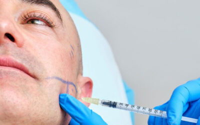 Botox para bruxismo: cómo funciona y cuánto dura