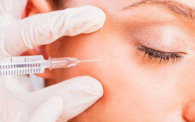 Qué es el botox facial y cómo actúa