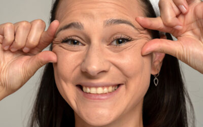 Cuánto dura el botox y cada cuánto retocarlo